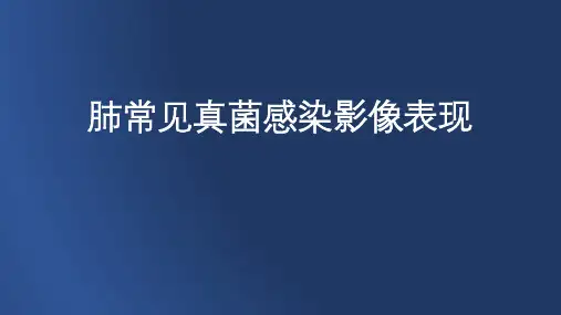 肺常见真菌感染影像表现