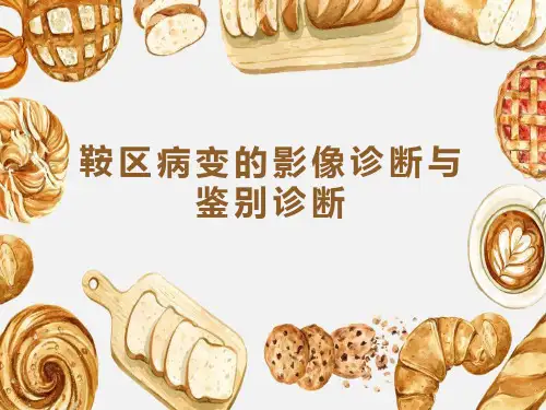 鞍区病变的影像诊断与鉴别诊断