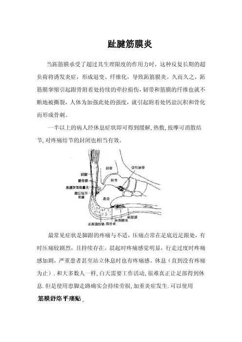 趾腱筋膜炎