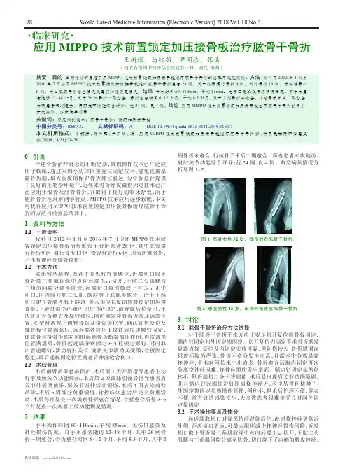 应用MIPPO技术前置锁定加压接骨板治疗肱骨干骨折