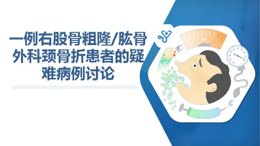 一例右股骨粗隆肱骨 外科颈骨折患者的疑 难病例讨论