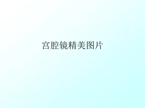 宫腔镜精美图片