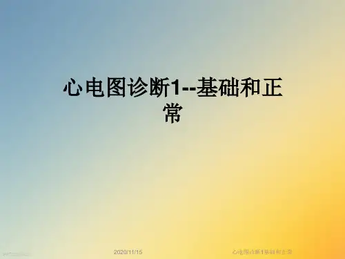 心电图诊断1基础和正常