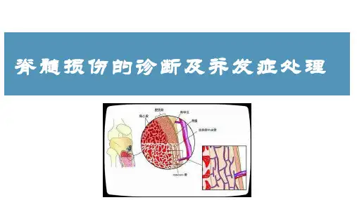 脊髓损伤的诊断及并发症处理
