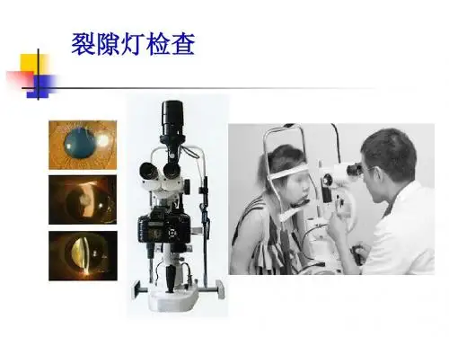 裂隙灯及眼底镜使用