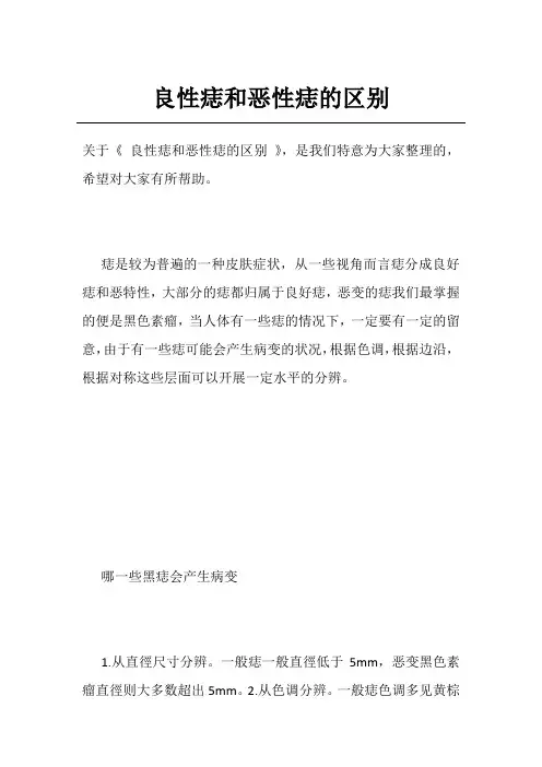良性痣和恶性痣的区别