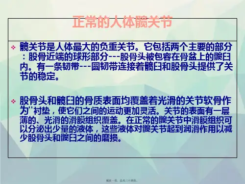 髋关节置换术PPT