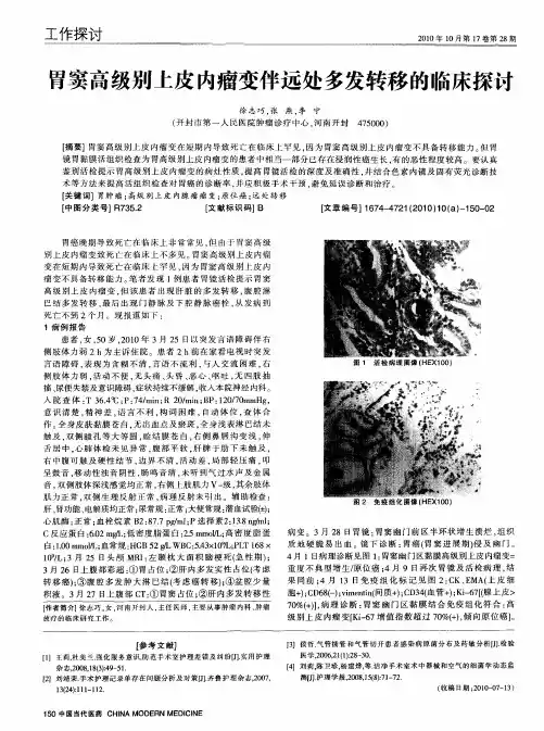 胃窦高级别上皮内瘤变伴远处多发转移的临床探讨