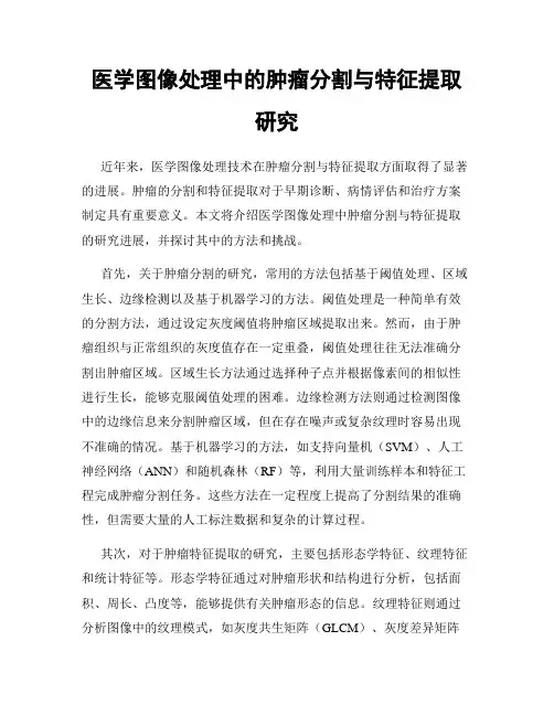 医学图像处理中的肿瘤分割与特征提取研究