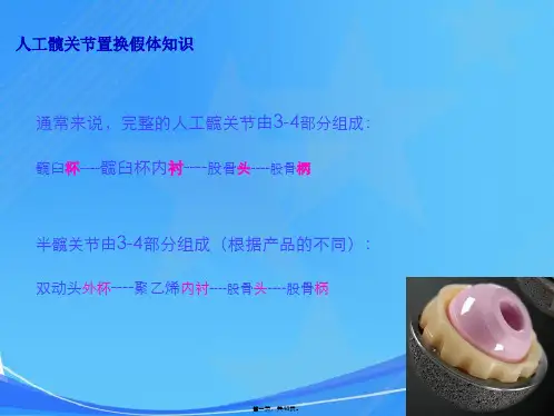 人工髋关节置换假体知识