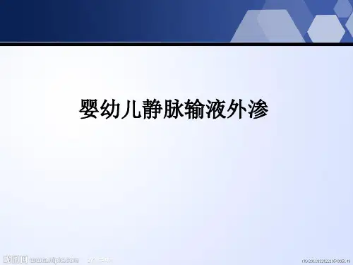 婴幼儿静脉输液外渗ppt课件