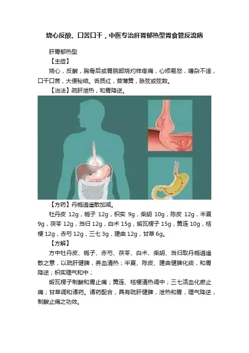 烧心反酸、口苦口干，中医专治肝胃郁热型胃食管反流病