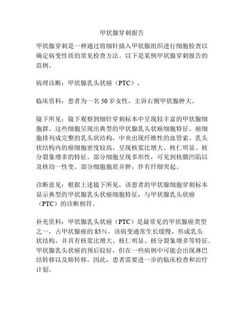 甲状腺穿刺报告