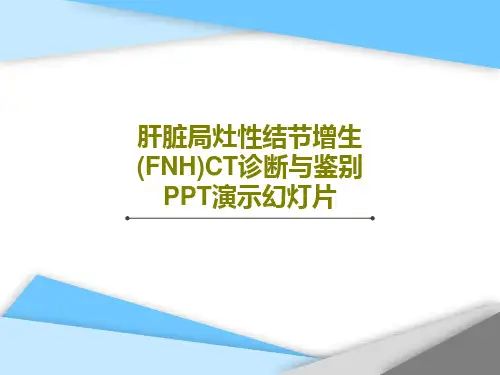 肝脏局灶性结节增生(FNH)CT诊断与鉴别PPT演示幻灯片共54页PPT