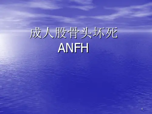 (医学课件)股骨头坏死 最新医学PPT