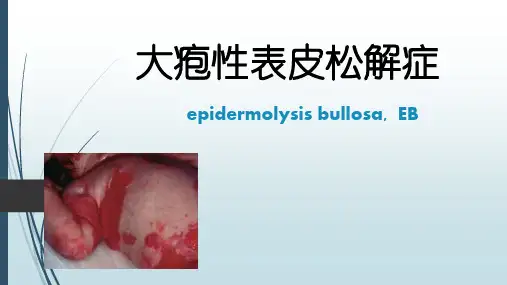 大疱性表皮松解症