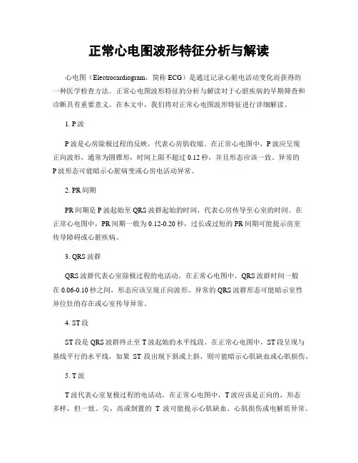 正常心电图波形特征分析与解读