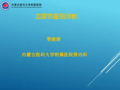 血尿的鉴别诊断