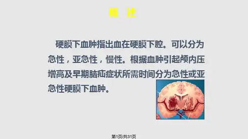 慢性硬膜下血肿护理查房PPT课件