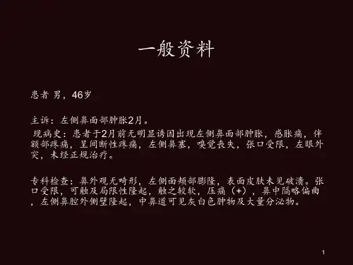 鼻窦ppt课件