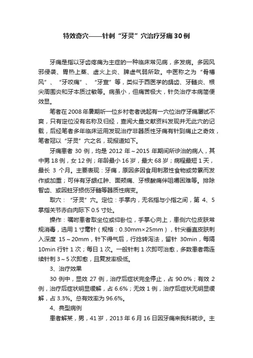 特效奇穴——针刺“牙灵”穴治疗牙痛30例
