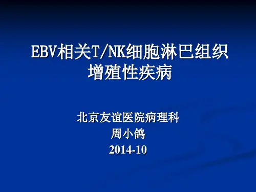 周小鸽-EBV相关TNK细胞淋巴组织增殖性疾病