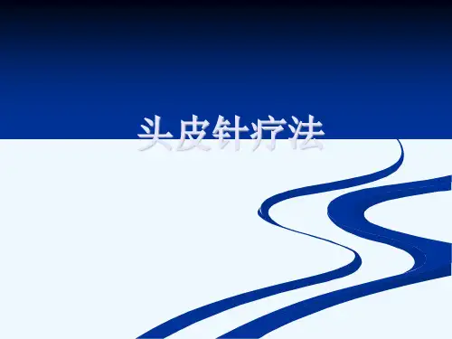头皮针疗法