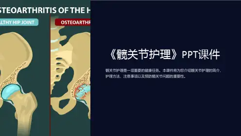 《髋关节护理》课件