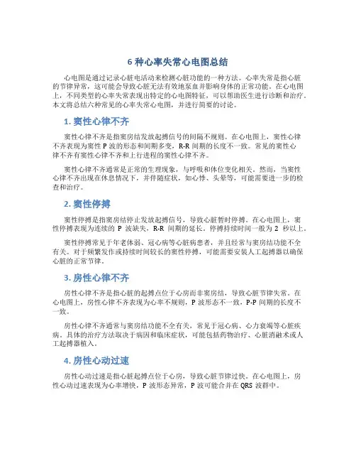 6种心率失常心电图总结