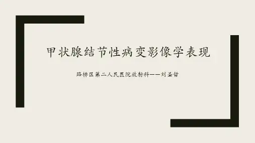 甲状腺结节性病变影像学表现