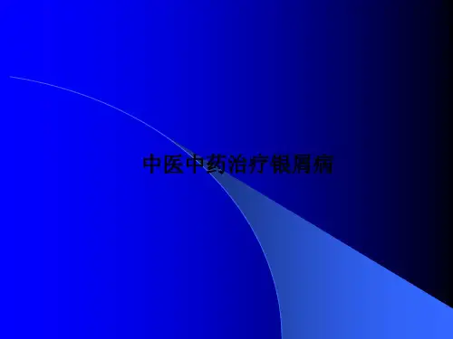 中医中药治疗银屑病