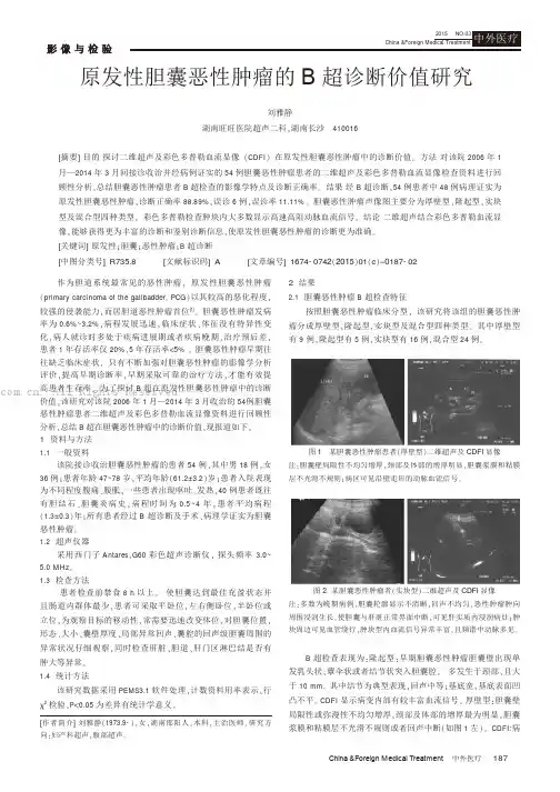 原发性胆囊恶性肿瘤的B超诊断价值研究