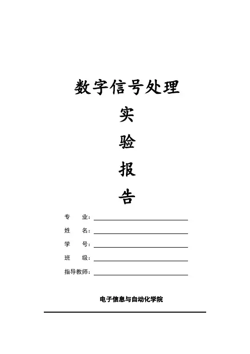 基于MATLAB的IIR数字滤波器设计——心电图采集系统