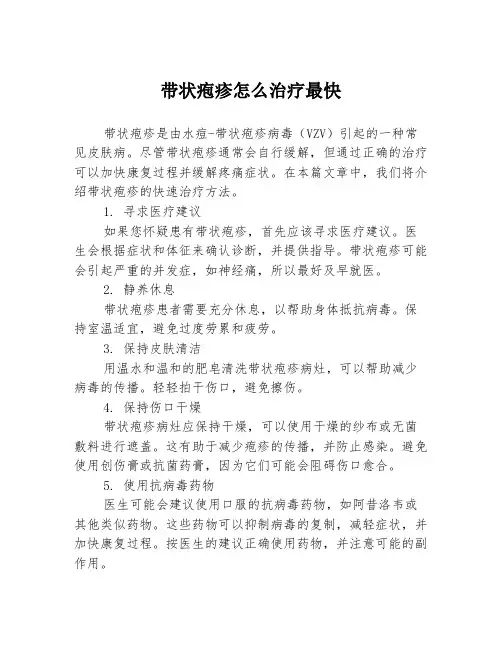 带状疱疹怎么治疗最快