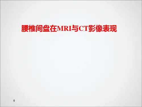 腰椎CT和MRI的区别ppt课件