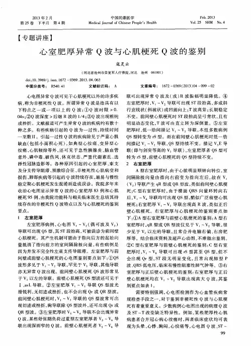心室肥厚异常Q波与心肌梗死Q波的鉴别
