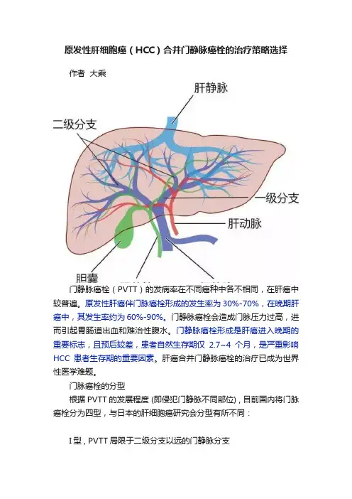 原发性肝细胞癌（HCC）合并门静脉癌栓的治疗策略选择