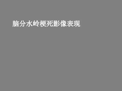 分水岭脑梗死影像表现