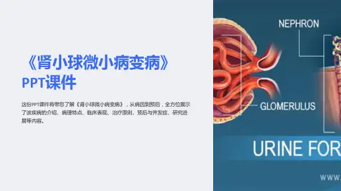 《肾小球微小病变病》课件