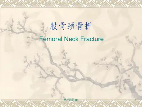 《股骨颈骨折》PPT课件