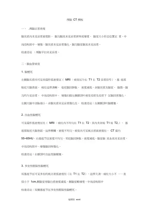 颅脑CT报告模版