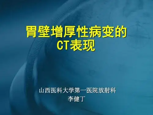 胃壁增厚性病变的CT表现