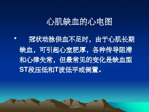 《心电图课件》
