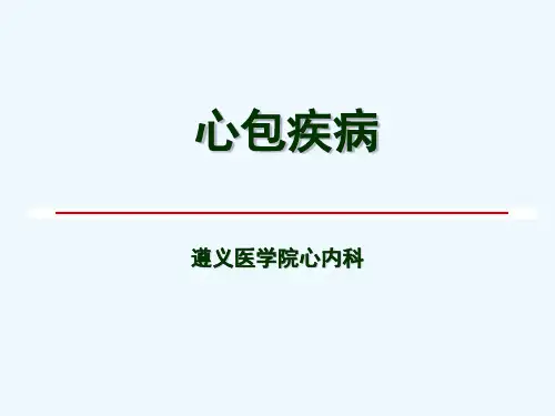 特发性右室流出道室速