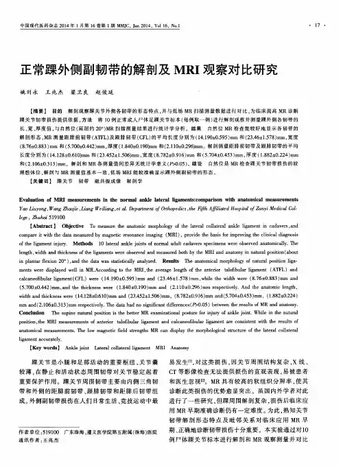 正常踝外侧副韧带的解剖及MRI观察对比研究
