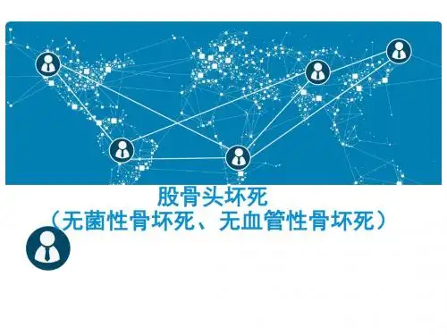 股骨头坏死