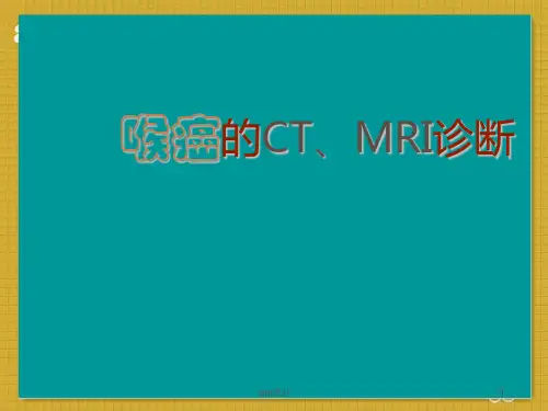 喉癌的CT、MRI诊断  ppt课件