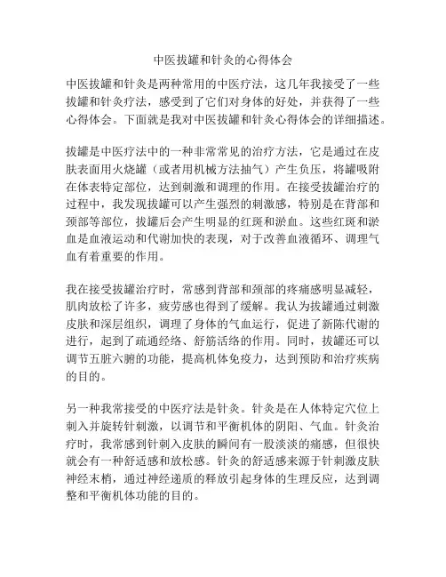 中医拔罐和针灸的心得体会