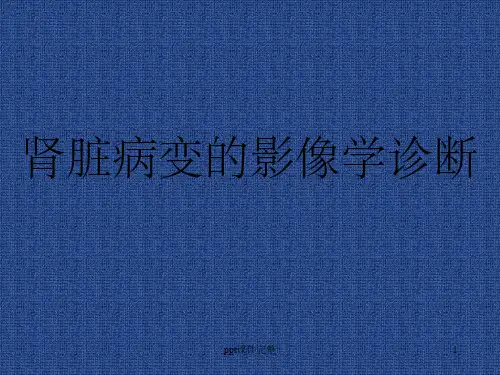 肾脏病变的影像诊断ppt课件
