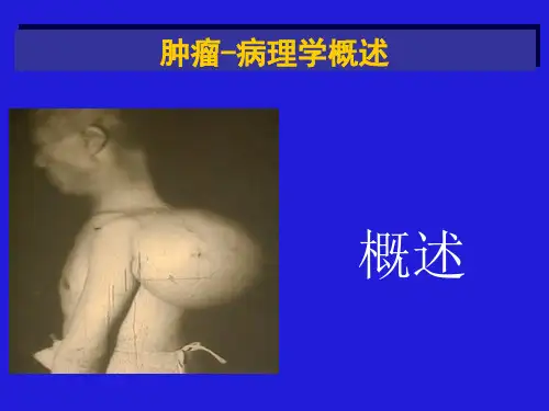 肿瘤-病理学概述参考PPT